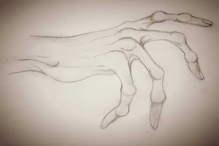 Кости кисти руки Баммес