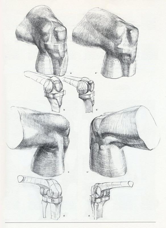 Коленный сустав анатомия Баммес