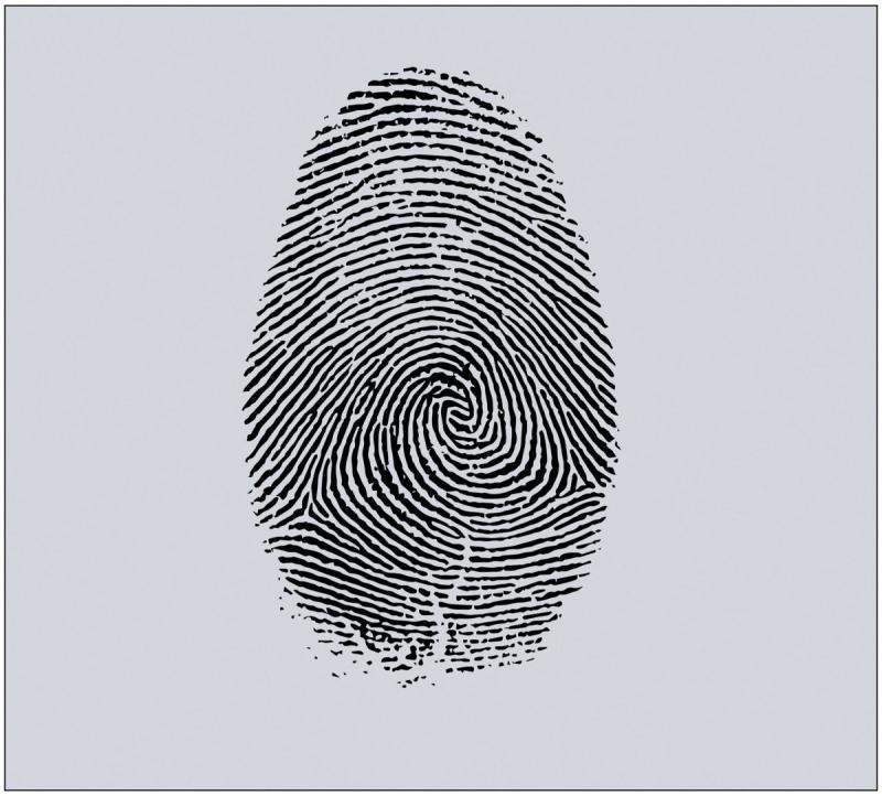 Петлевой радиальный папиллярные узоры